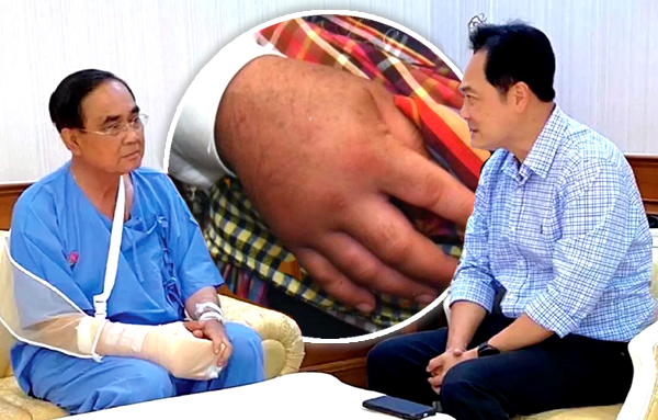 pm-prayut-hospitalised-with-chronic-arthritic-malady-that-impacts-3%-of-people-over-60-–-thai-examiner