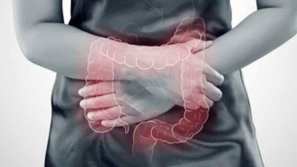 cancro-al-colon:-non-sottovalutare-mai-questi-sintomi